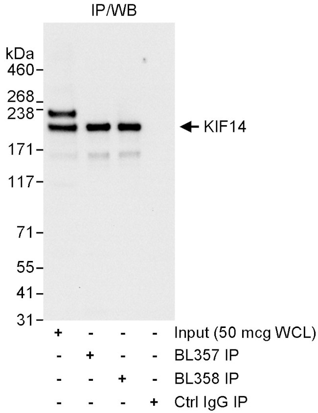 KIF14 Antibody in Western Blot (WB)
