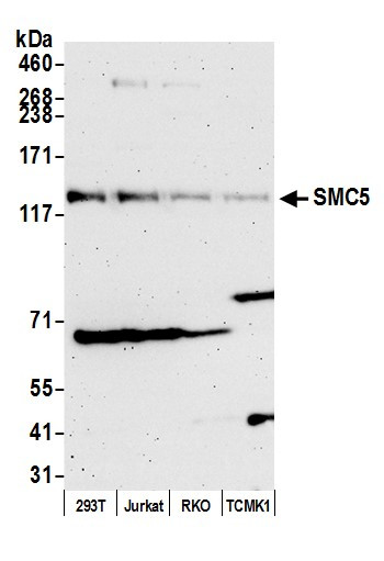 SMC5 Antibody in Western Blot (WB)