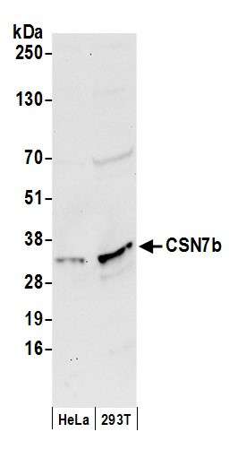 CSN7b Antibody in Western Blot (WB)