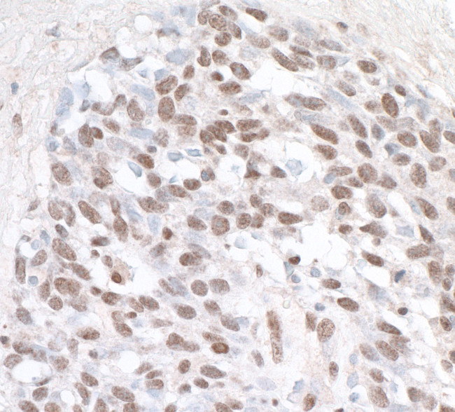 ZHX1 Antibody in Immunohistochemistry (Paraffin) (IHC (P))