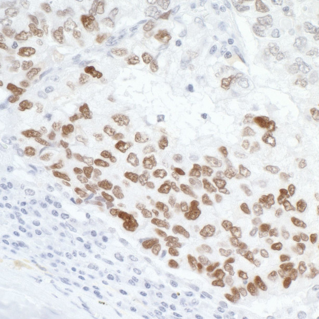 p53 Antibody in Immunohistochemistry (Paraffin) (IHC (P))