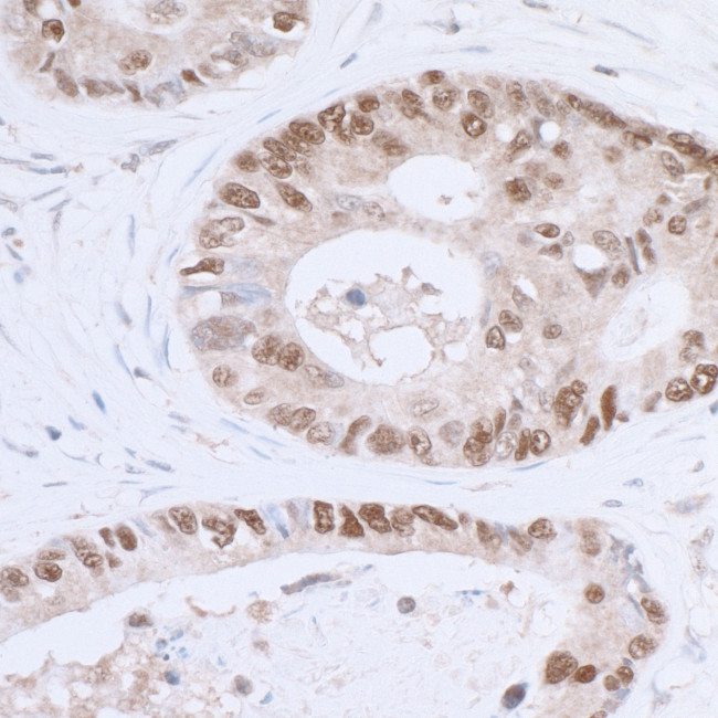 p53 Antibody in Immunohistochemistry (Paraffin) (IHC (P))