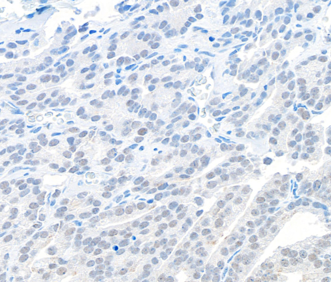 EMSY Antibody in Immunohistochemistry (Paraffin) (IHC (P))