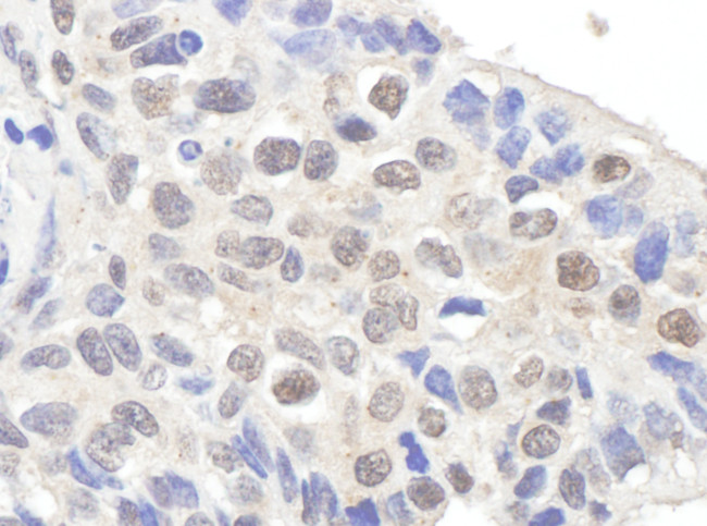 Claspin Antibody in Immunohistochemistry (Paraffin) (IHC (P))