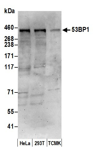 53BP1 Antibody in Western Blot (WB)