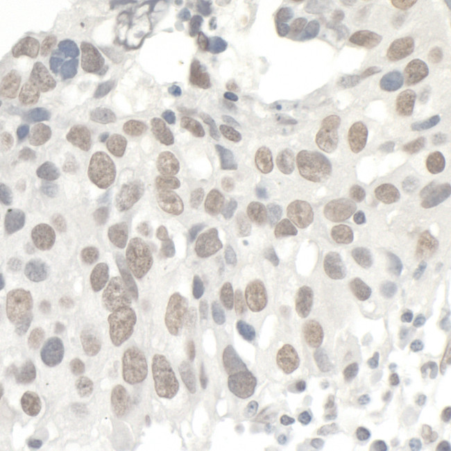 KAP-1 Antibody in Immunohistochemistry (Paraffin) (IHC (P))
