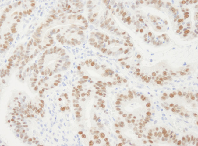 PCNA Antibody in Immunohistochemistry (Paraffin) (IHC (P))