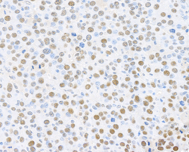 PCNA Antibody in Immunohistochemistry (Paraffin) (IHC (P))