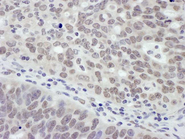 MTA1 Antibody in Immunohistochemistry (Paraffin) (IHC (P))