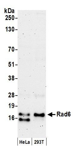Rad6 Antibody in Western Blot (WB)
