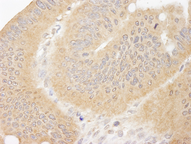 CC2D1A Antibody in Immunohistochemistry (Paraffin) (IHC (P))