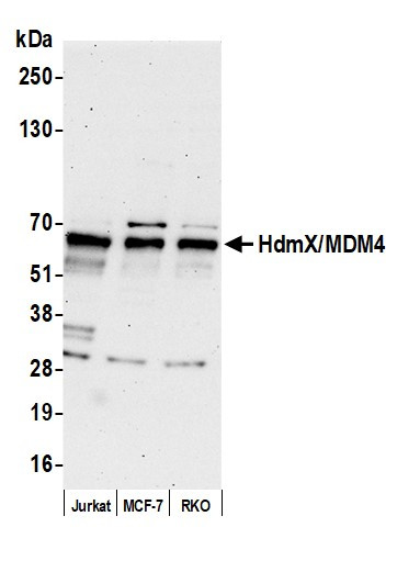 HdmX/MDM4 Antibody in Western Blot (WB)