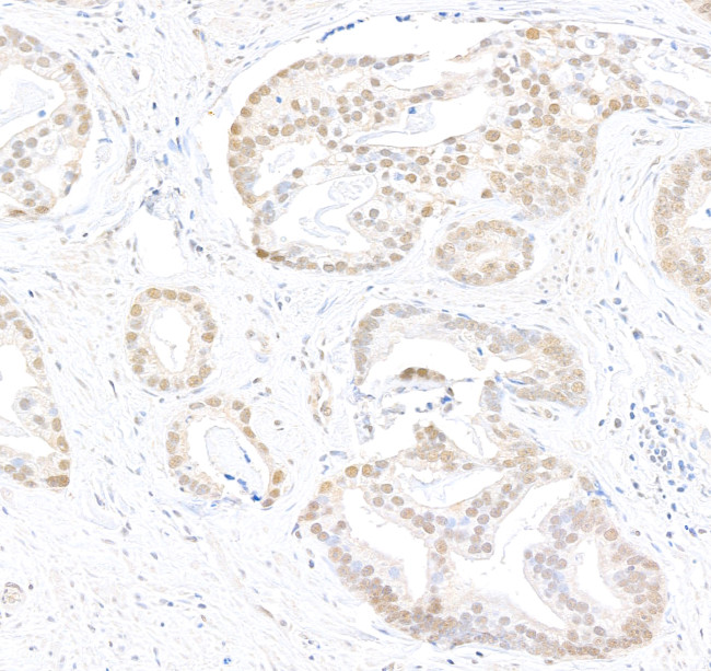 Caper Antibody in Immunohistochemistry (Paraffin) (IHC (P))