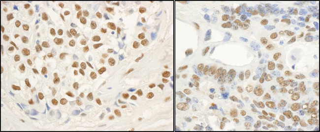 FUS Antibody in Immunohistochemistry (Paraffin) (IHC (P))