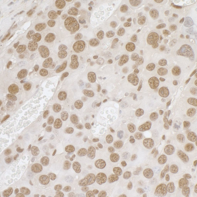 FUS Antibody in Immunohistochemistry (Paraffin) (IHC (P))