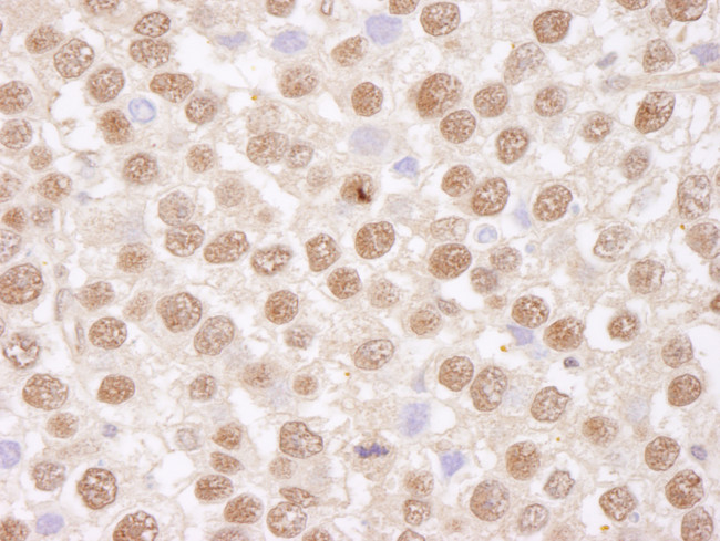 TAFII68 Antibody in Immunohistochemistry (Paraffin) (IHC (P))