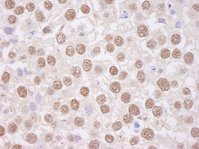 TAFII68 Antibody in Immunohistochemistry (Paraffin) (IHC (P))