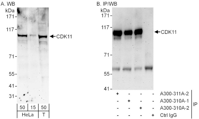 CDK11 Antibody in Western Blot (WB)