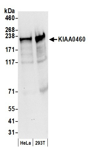 KIAA0460 Antibody in Western Blot (WB)