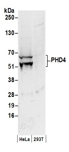 PHD4 Antibody in Western Blot (WB)