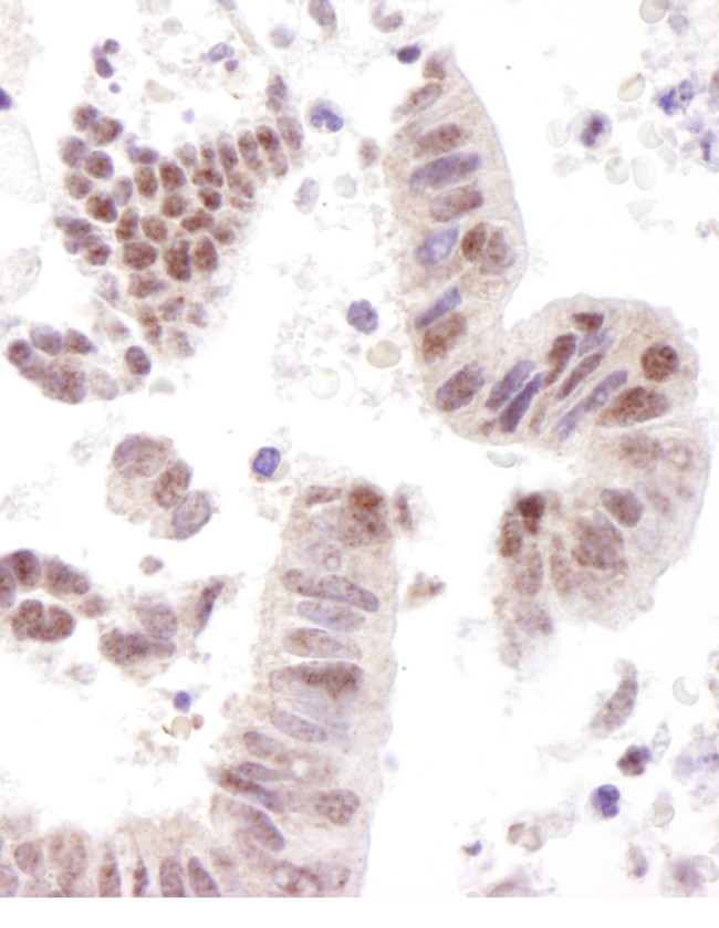 CoAA Antibody in Immunohistochemistry (Paraffin) (IHC (P))