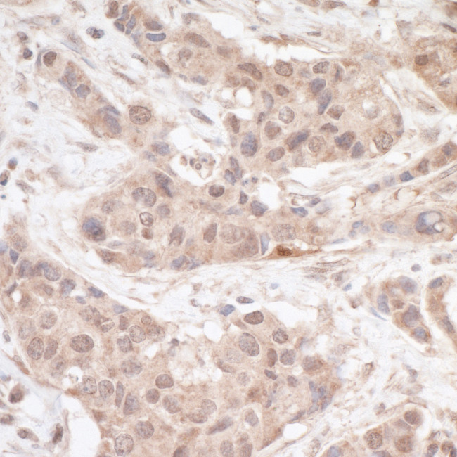 FHL2 Antibody in Immunohistochemistry (Paraffin) (IHC (P))