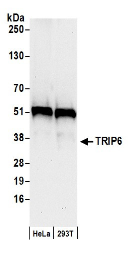 TRIP6 Antibody in Western Blot (WB)