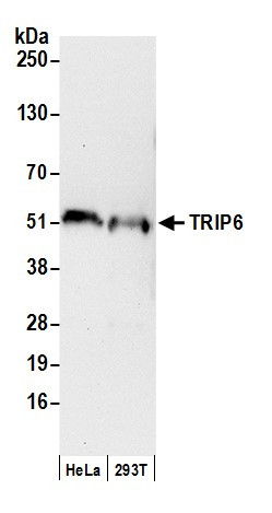 TRIP6 Antibody in Western Blot (WB)