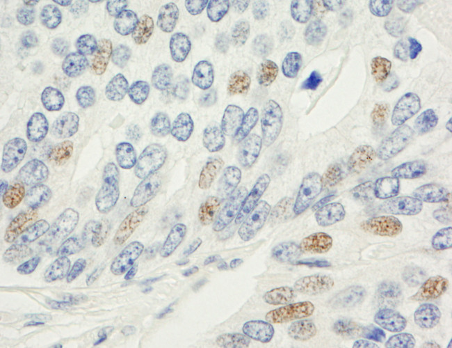 MAD1 Antibody in Immunohistochemistry (Paraffin) (IHC (P))