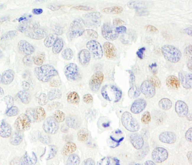 p14ARF Antibody in Immunohistochemistry (Paraffin) (IHC (P))