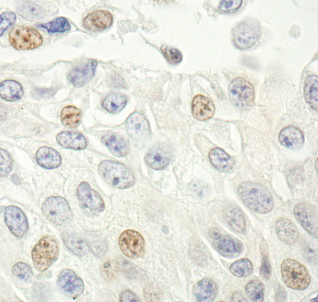 p14ARF Antibody in Immunohistochemistry (Paraffin) (IHC (P))