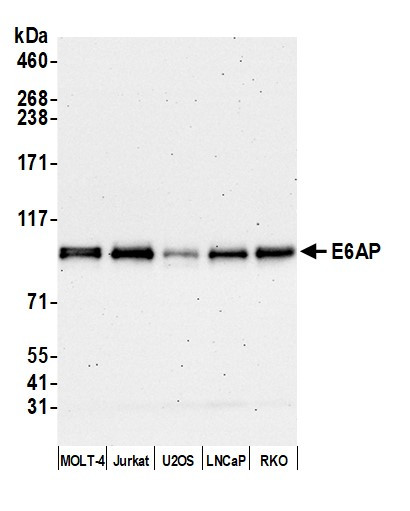 E6AP Antibody in Western Blot (WB)