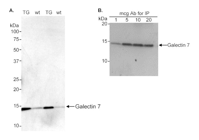 Galectin-7 Antibody in Western Blot (WB)