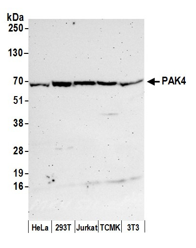 PAK4 Antibody in Western Blot (WB)