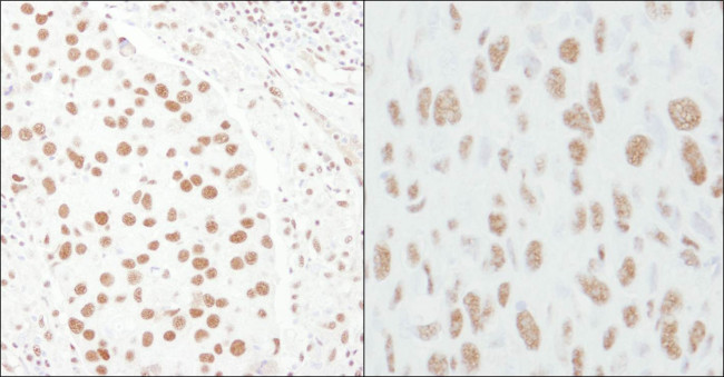 CA150 Antibody in Immunohistochemistry (Paraffin) (IHC (P))