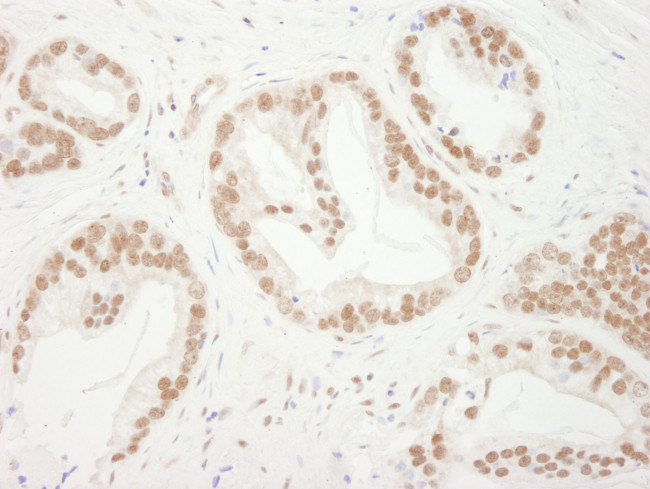 Bub3 Antibody in Immunohistochemistry (Paraffin) (IHC (P))