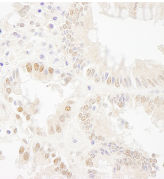 Bub1 Antibody in Immunohistochemistry (Paraffin) (IHC (P))