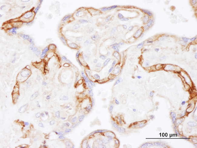 EGFR Antibody in Immunohistochemistry (Paraffin) (IHC (P))