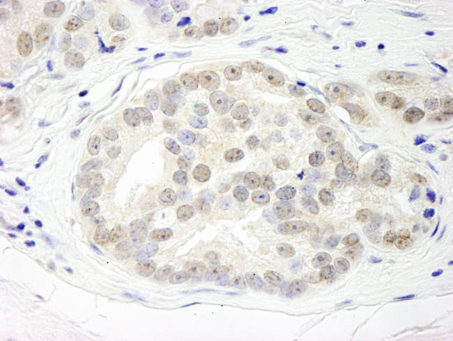 DHX15 Antibody in Immunohistochemistry (Paraffin) (IHC (P))