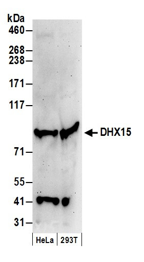 DHX15 Antibody in Western Blot (WB)