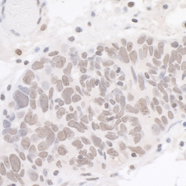 CDK7 Antibody in Immunohistochemistry (Paraffin) (IHC (P))