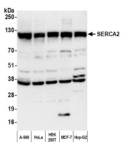 SERCA2 Antibody in Western Blot (WB)