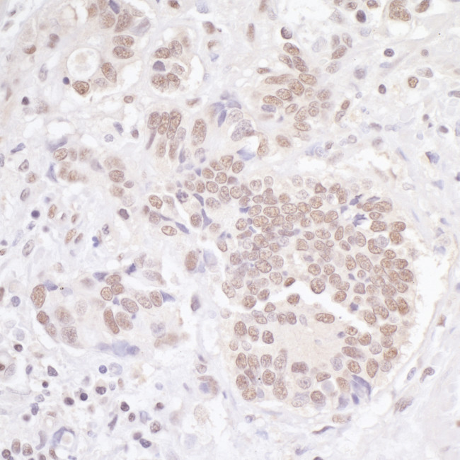 TBLR1 Antibody in Immunohistochemistry (Paraffin) (IHC (P))