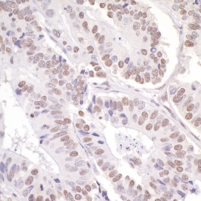 ASC2 Antibody in Immunohistochemistry (Paraffin) (IHC (P))