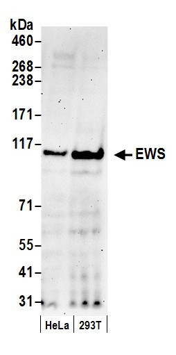 EWS Antibody in Western Blot (WB)