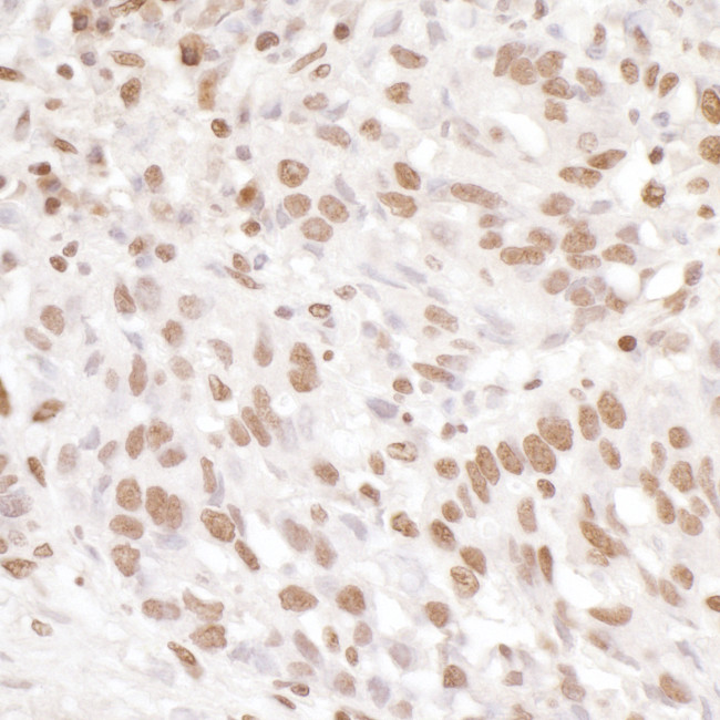 EWS Antibody in Immunohistochemistry (Paraffin) (IHC (P))
