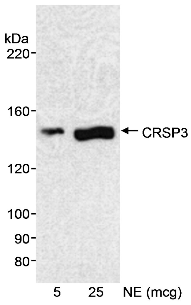 CRSP3 Antibody in Western Blot (WB)