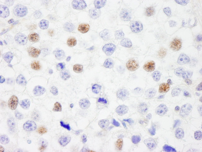 IRF3 Antibody in Immunohistochemistry (Paraffin) (IHC (P))