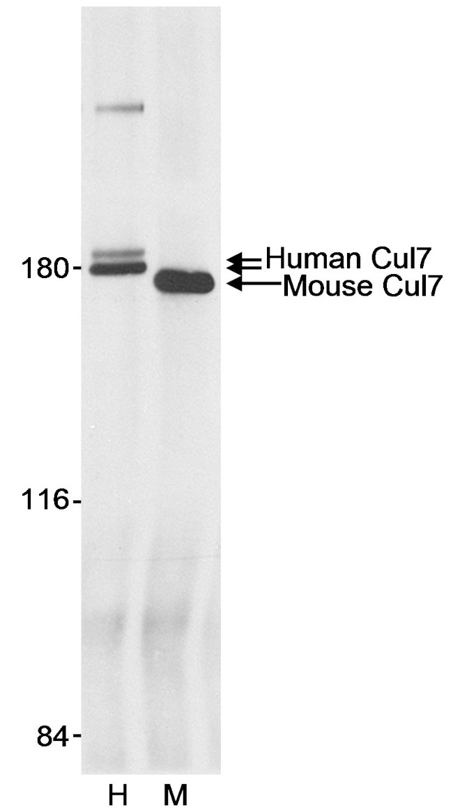 Cul7 Antibody in Immunoprecipitation (IP)