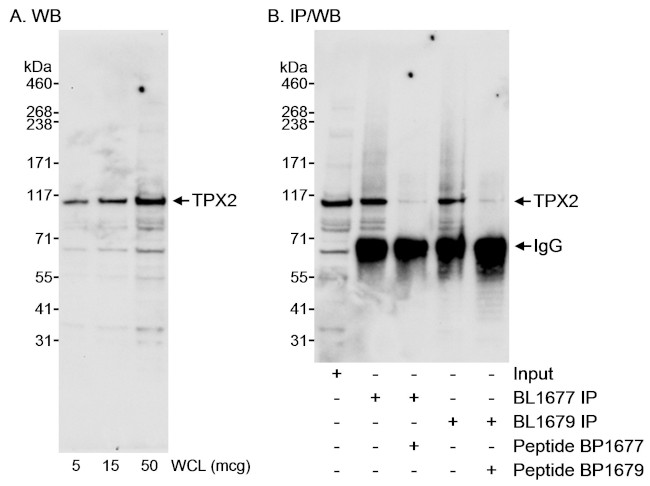 TPX2 Antibody in Western Blot (WB)